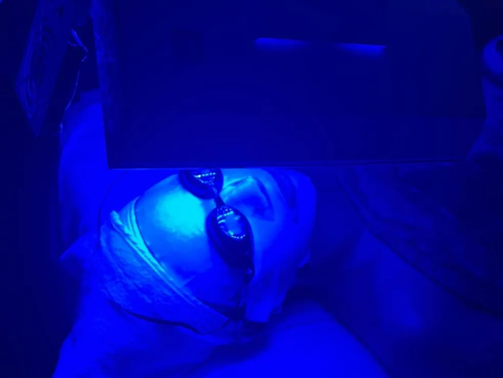 LED 光疗治疗