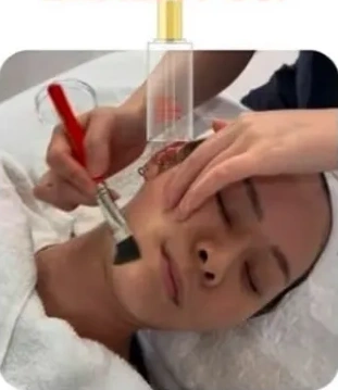 LHALA Peel solution